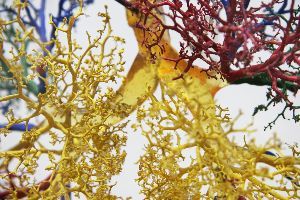 Flugthrombose - Reisethrombose